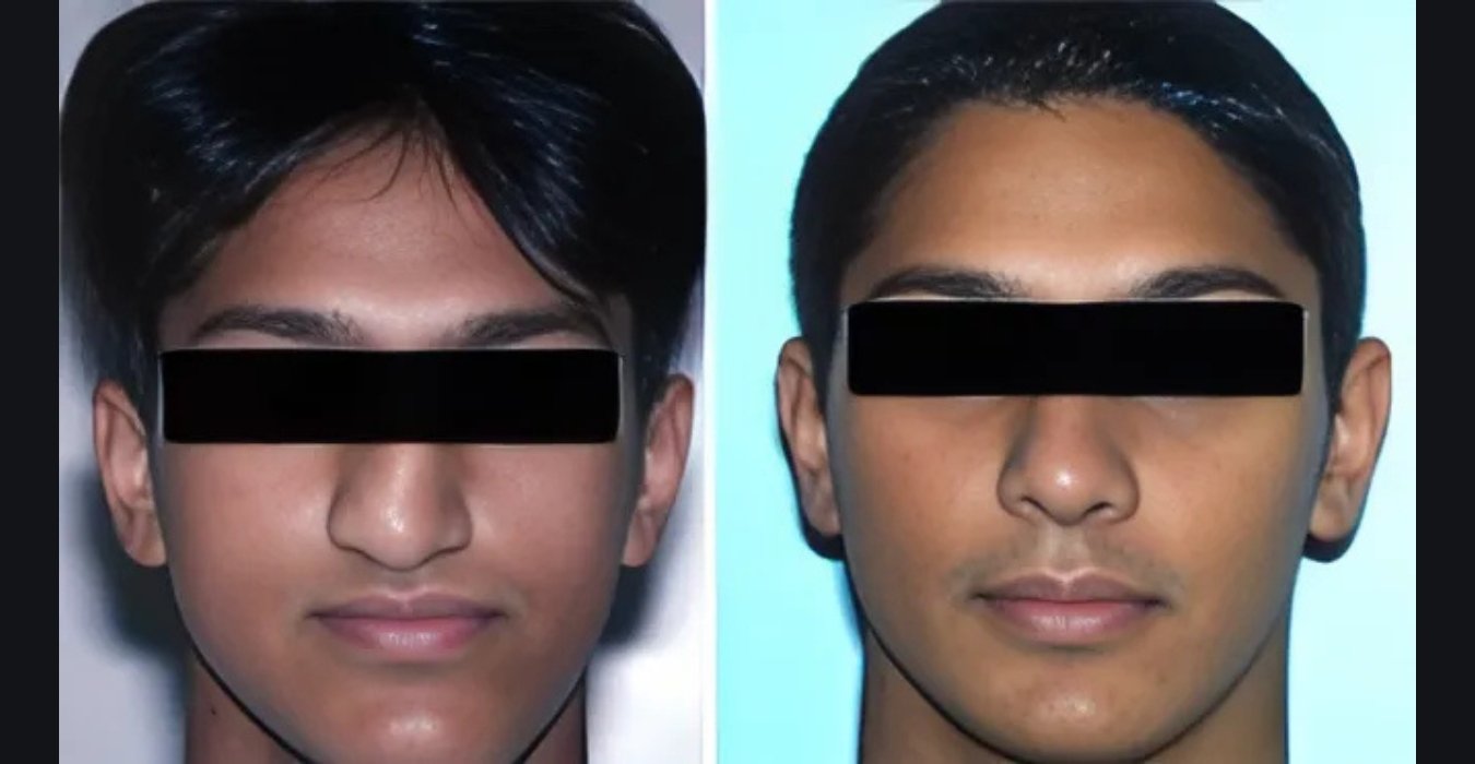 Craniofacial Surgery in Jubilee Hills & Film Nagar, Hyderabad