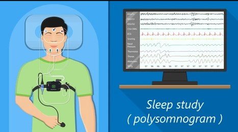 Sleep study for diagnosing snoring and sleep apnea at Somnio Clinic, Hyderabad