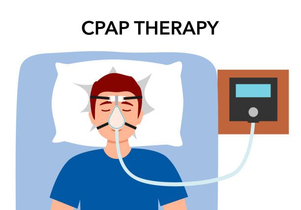 sleep apnea treatment with CPAP device in hyderabad