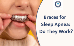 Can Dental Braces Really Help Treat Sleep Apnea?