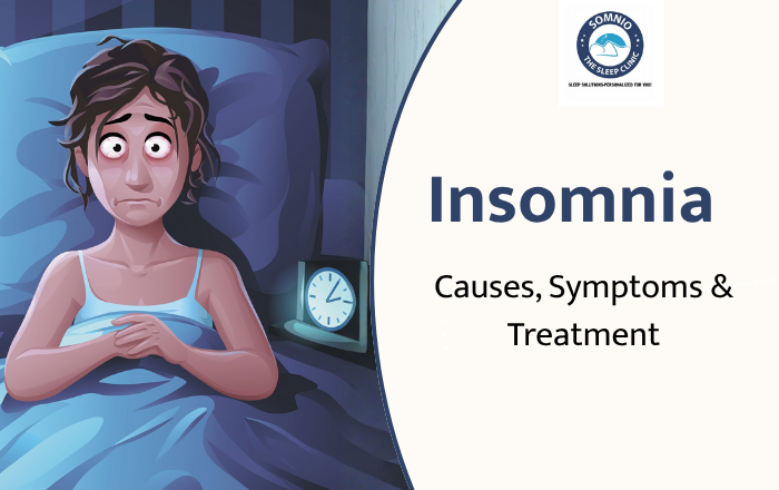 Insomnia: What It Is, Causes, Symptoms & Treatment