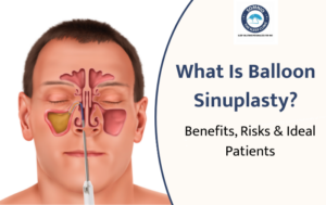 What Is Balloon Sinuplasty? Benefits, Risks & Ideal Candidates