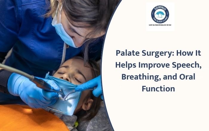 Palate Surgery: